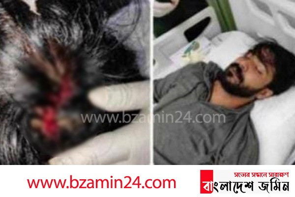 রক্তাক্ত অবস্থায় হাসপাতালে রাজ 